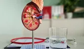 Ce alimente îți pot provoca deshidratare fără să îți dai seama