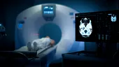 Ce au descoperit medicii când i-au făcut un CT unui bărbat în vârstă de 70 de ani