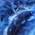Cancerul pancreatic ar putea fi depistat cu până la 5 ani înainte. Cum ar putea ajuta inteligența artificială
