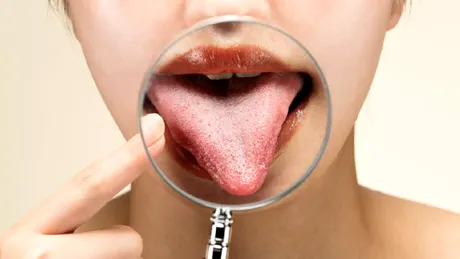 Gustul metalic în gură: medicamentele, problemele dentare și alte cauze posibile