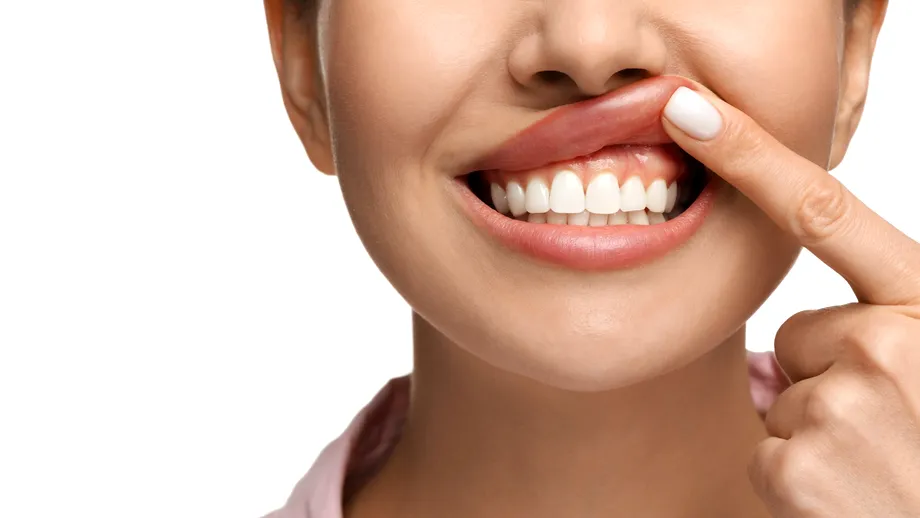 Monitorizarea radiologică în parodontopatii