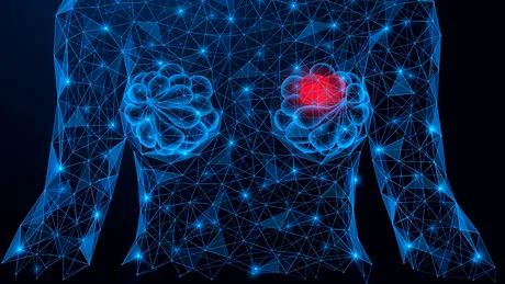 Ce sunt chisturile mamare și de ce sunt femeile cu sâni mici mai predispuse la apariția acestora