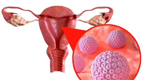 Legătura dintre HPV și fertilitate. Impactul infecției cu HPV asupra fertilității