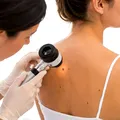 (P) Alunițe, pete, mâncărimi sau leziuni care nu se vindecă: ce modificări ale pielii ar trebui evaluate de dermatolog