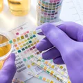 Ceaiul care ajută la ameliorarea infecțiilor urinare. Remediul vechi folosit de bunici pentru sănătatea rinichilor