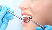 Ace uitate pe canal – Tu ştii ce-ţi face dentistul?