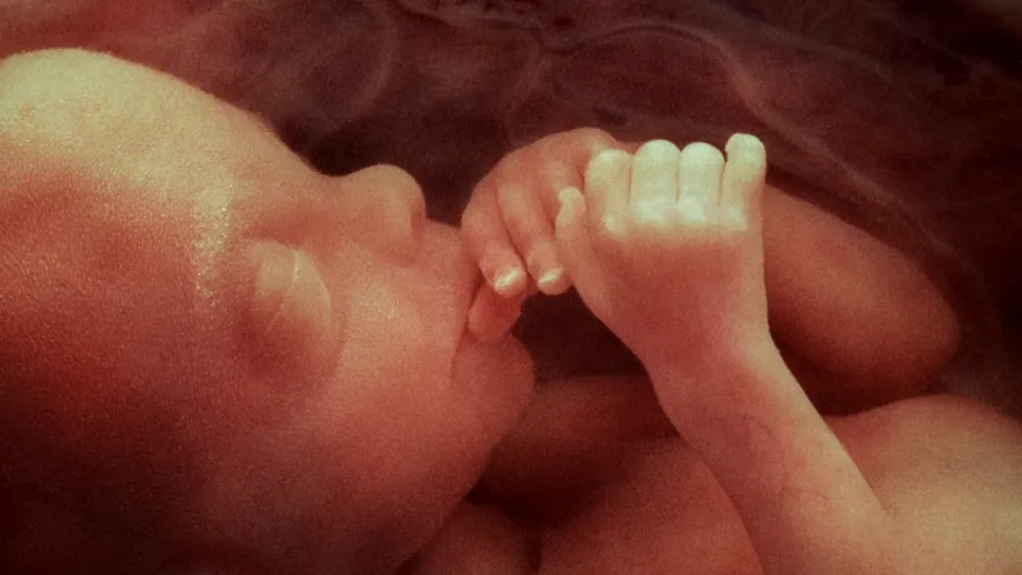 Caz extrem de rar. Un fetus a fost extras din creierul unei fetițe de un an care nu putea să stea în șezut și avea circumferința craniană mărită