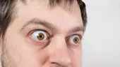 8 boli care ți se citesc în privire. Ce semne dau ochii când ai un AVC sau probleme cu ficatul ori tiroida