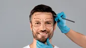 4 intervenții estetice minim invazive pentru bărbații care își doresc un contur facial mai masculin