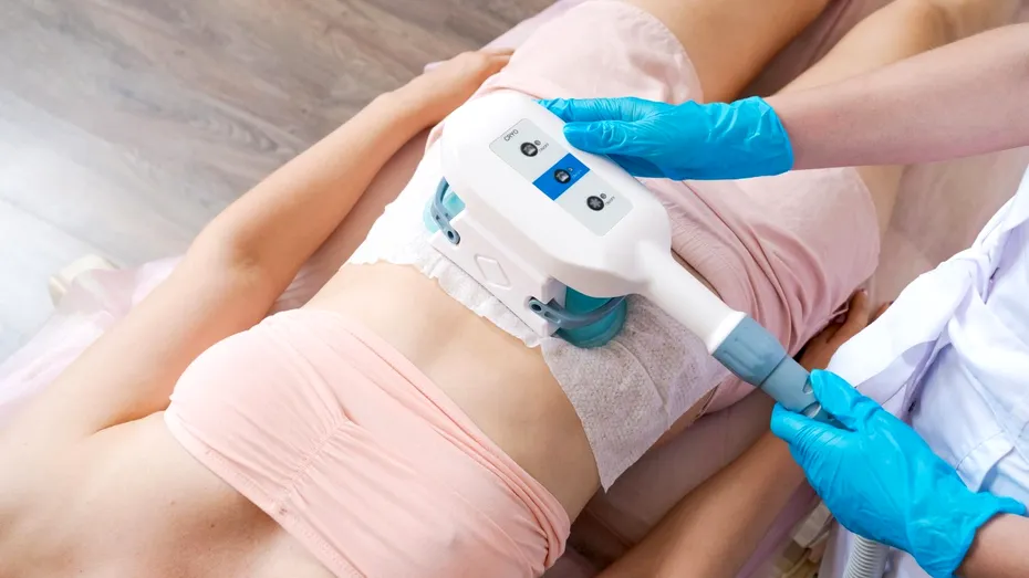 (P) Criolipoliza: cum funcționează înghețarea grăsimii, ce rezultate dă și cum alegeți o clinică serioasă