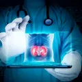 Boala rară care poate începe cu simptome la rinichi, dar poate afecta creierul și inima
