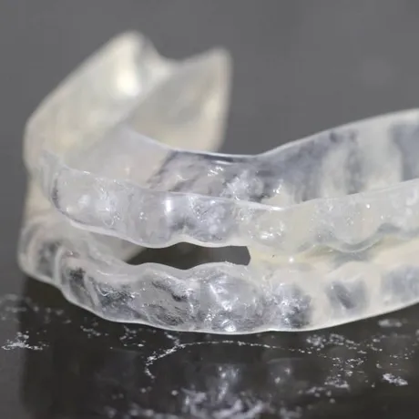 Ce trebuie să știi dacă urmează să porți un aparat dentar invizibil pentru adulți