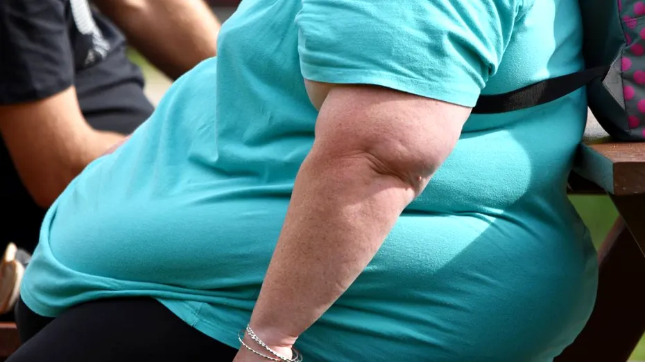 Diagnosticul de obezitate înainte de 30 de ani crește riscul de moarte prematură cu 70%