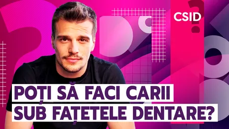 Poți să faci carii sub fațetele dentare?