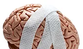Tratamentul traumatismelor cranio-cerebrale, o prioritate pentru sistemul medical românesc