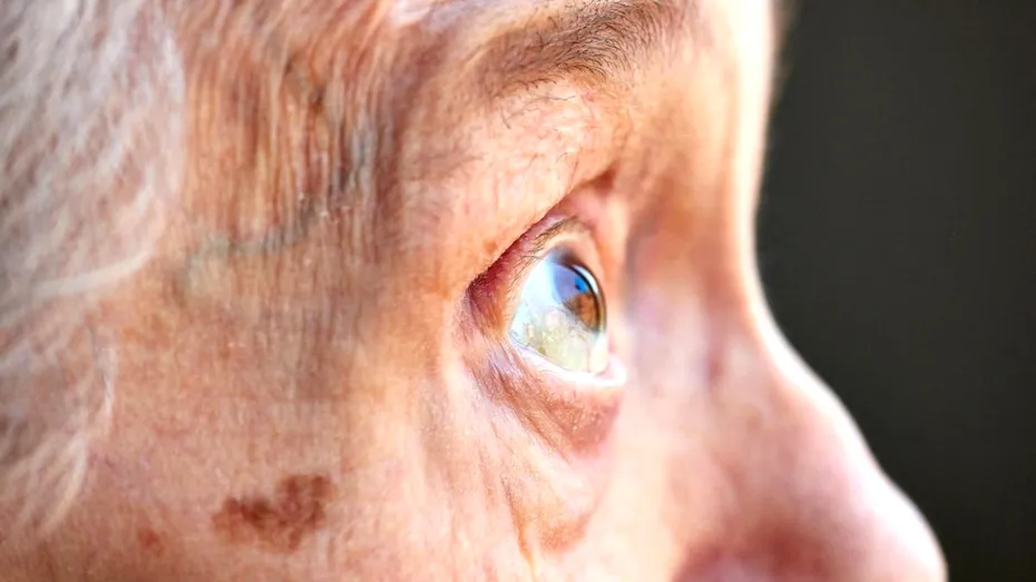 Demența dă semne încă de la 45 de ani, dar nu le băgăm în seamă. Ce indicii dau ochii când ai risc crescut de boală Alzheimer