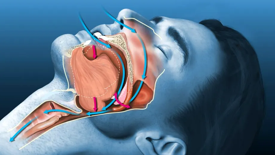 Sforăi în somn? De ce nu e bine să dormi cu gura deschisă