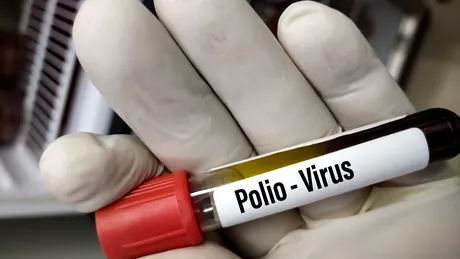Virusul poliomielitei revine! Avertismentul unui specialist în boli infecțioase: Următoarea epidemie se află la distanță de un zbor. Trebuie să începem să ne pregătim