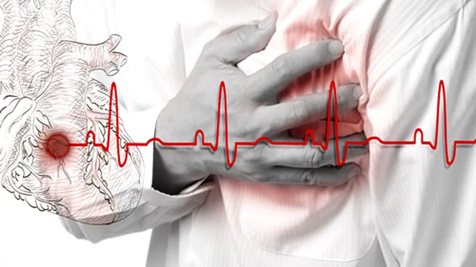 Căldura, factor de risc pentru infarctul de miocard