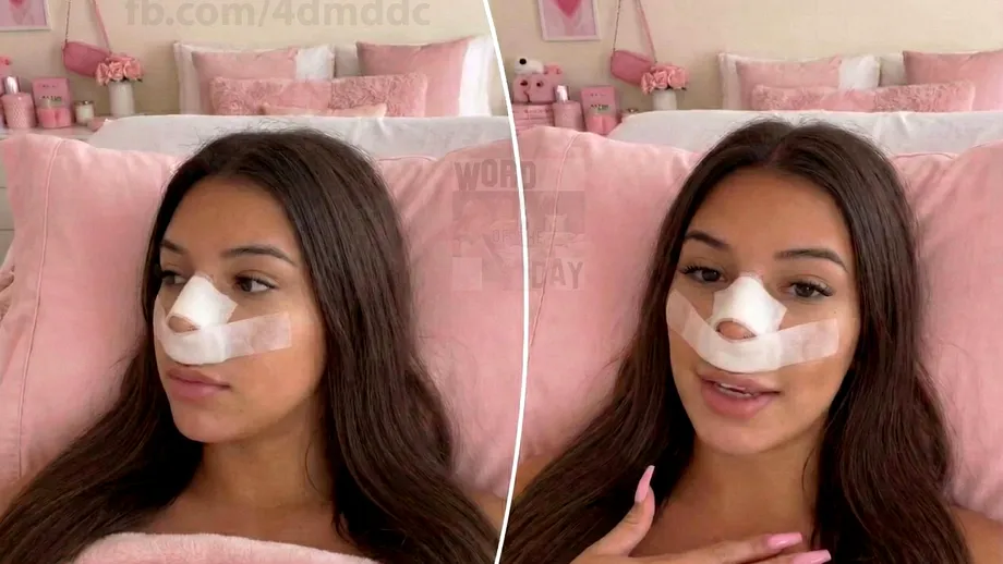 Influencerița care și-a făcut rinoplastie pentru ca viitorii copii „să nu-i moștenească nasul