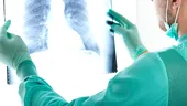 „Tu ştii câţi ani au plămânii tăi?” Fă-ţi o spirometrie gratuită ca să afli!