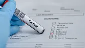 14 semne care apar când cortizolul scapă de sub control