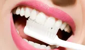 Ce se întâmplă cu dinţii tăi dacă nu îi cureţi corespunzător