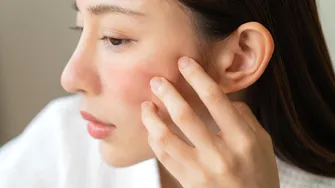 Cele mai nocive alimente pentru piele, dezvăluite de un chirurg plastician! Sunt de evitat dacă vrei un ten ferm