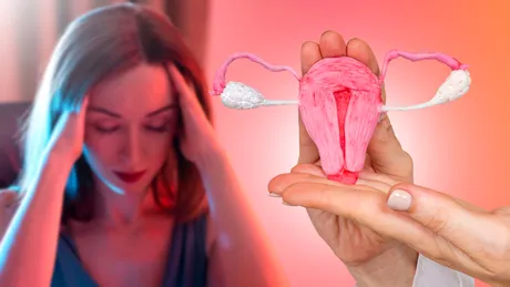 Legătura dintre endometrioză și cancerul ovarian. Ce simptome recomandă medicii să urmărești