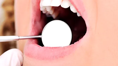 5 situaţii în care ai nevoie de coroană dentară