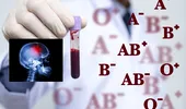 Grupa de sânge asociată cu un risc mai mare de AVC înainte de 60 de ani. Ce au descoperit cercetătorii