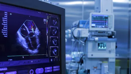Dr. Lucian Dorobanţu: operaţia pe inimă, de la clasic la minim invaziv VIDEO BY CSID