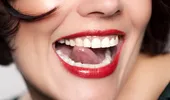 10 Obiceiuri ale dinţilor frumoşi