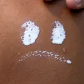 De ce bronzul dispare mai repede la unele tipuri de piele