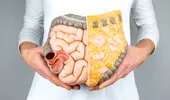 Semne ale cancerului de colon la tineri. Avertismentul transmis de un medic gastroenterolog