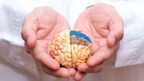 Analize care dezvăluie dacă ești la risc să faci accident vascular cerebral