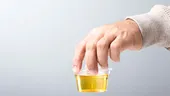 Ce spune culoarea urinei despre sănătatea ta
