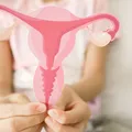 A crezut că suferă de endometrioză, dar diagnosticul a fost cumplit. O femeie de 42 de ani a rămas fără nouă organe