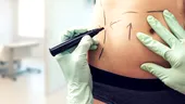 Un medic estetician din Constanța este anchetat pentru că a mutilat mai multe paciente. Tinerele au rămas cu sechele pe viață