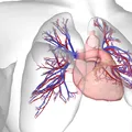 Hipertensiunea arterială pulmonară: o boală rară, complexă și deseori neînțeleasă