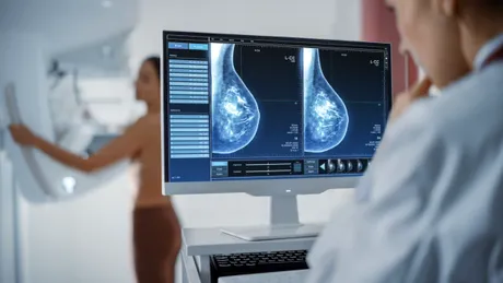 Mamografia este dureroasă sau periculoasă din cauza radiațiilor? 8 mituri și idei preconcepute despre screeningul cancerului mamar