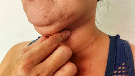 Exercițiul simplu care te scapă de bărbia dublă. Îl poți face zilnic acasă