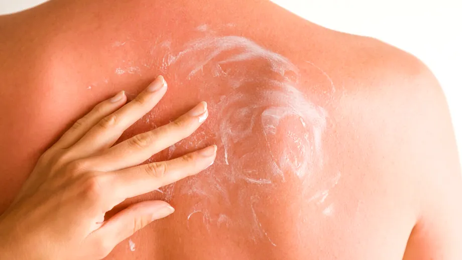 Remediul NATURAL pentru hemoroizi, furuncule și arsuri. Îl poți face acasă. Ce ai nevoie?