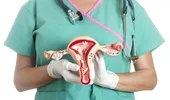 Cancerul ovarian: semnele celui mai agresiv cancer care afectează femeile