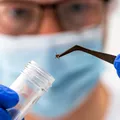 Formă rară de boală Lyme depistată recent: simptome mai severe și avertismentul medicilor