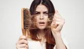 Căderea părului: ce boli poate ascunde