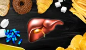 9 factori care îți pot distruge ficatul, chiar dacă nu bei alcool. Avertismentul medicilor