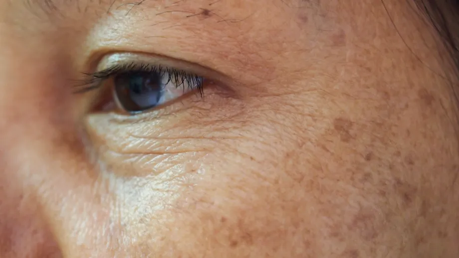 Această greșeală de skincare le îmbătrânește pe femeile sub 30 de ani, avertizează dermatologii
