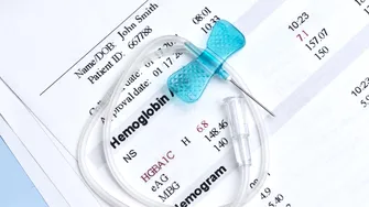10 motive medicale pentru care ai hemoglobina scăzută