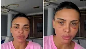 Andreea Popescu, dezvăluiri despre ultimele operații suferite: „Mi-a căzut părul enorm”. Ce intervenții estetice și-a făcut vedeta